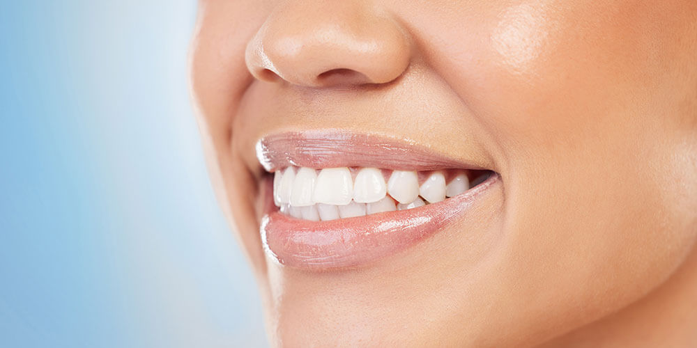 Fluoride Treatment Fort McMurray
