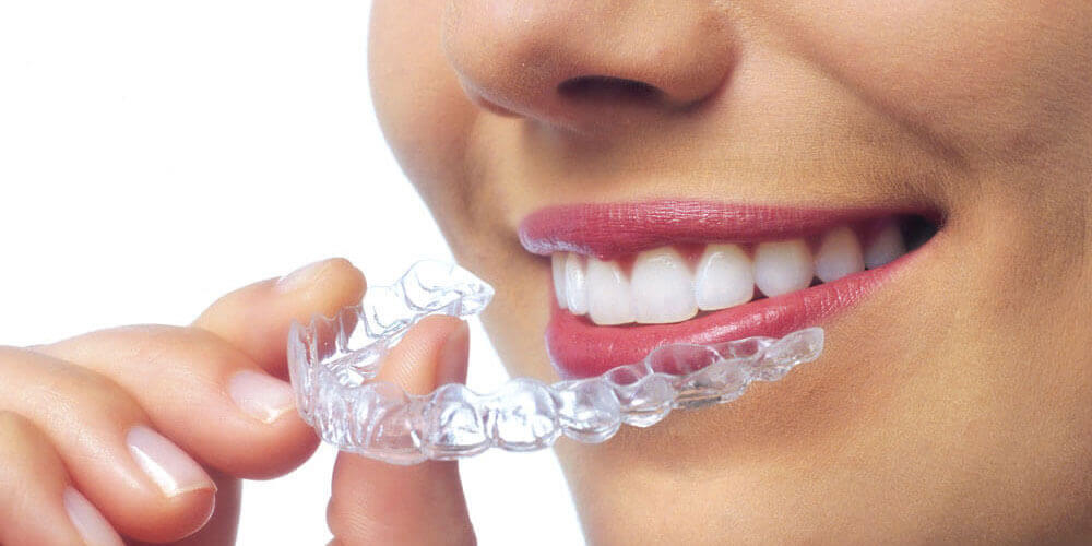 Free Invisalign Consultation