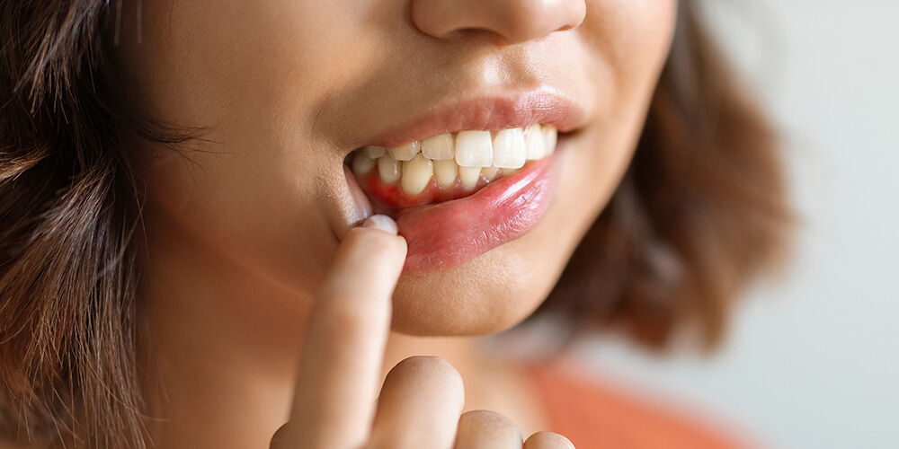 Periodontal Therapy Fort McMurray